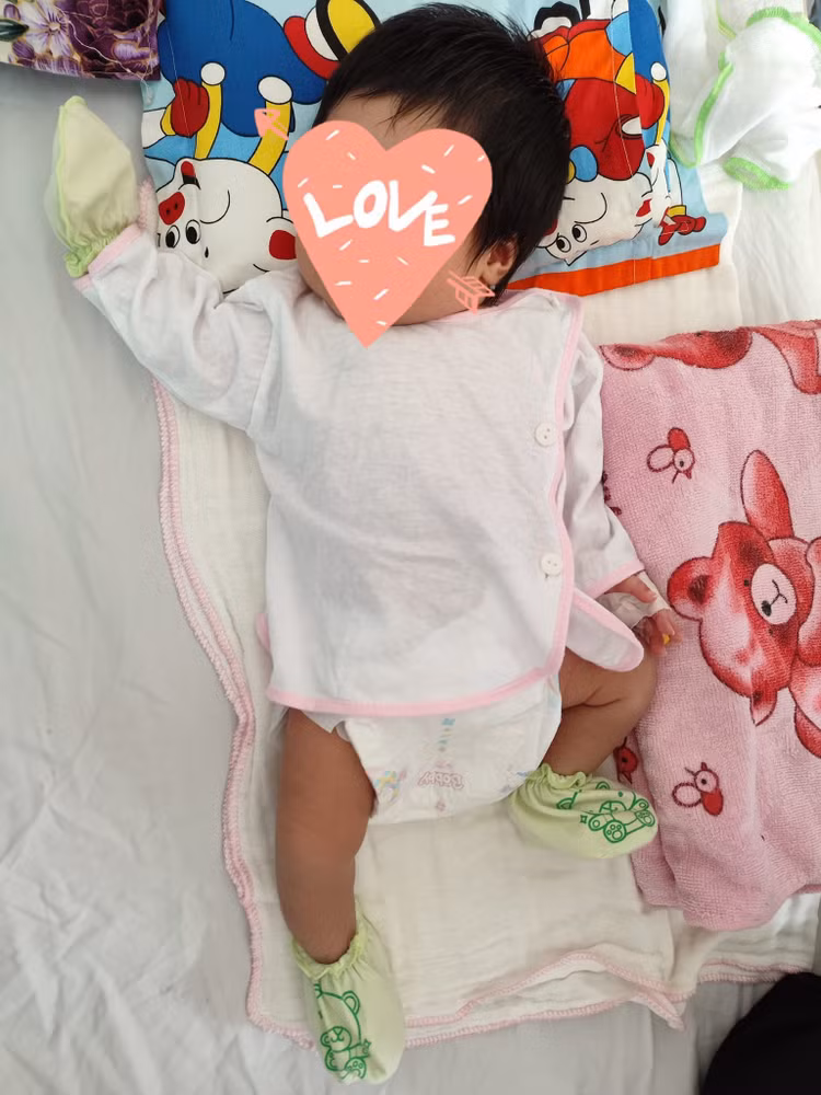 Trẻ vàng da nhiễm trùng nặng do bất đồng nhóm máu mẹ con