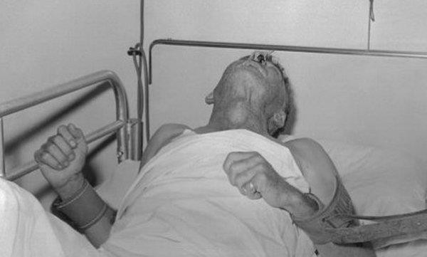 Một số trường hợp bị chó, mèo dại cắn nhưng không đi tiêm phòng đã bị tử vong