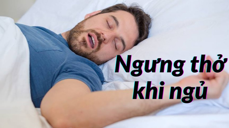 Hỏng mắt vì chứng ngưng thở khi ngủ - Ảnh minh họa