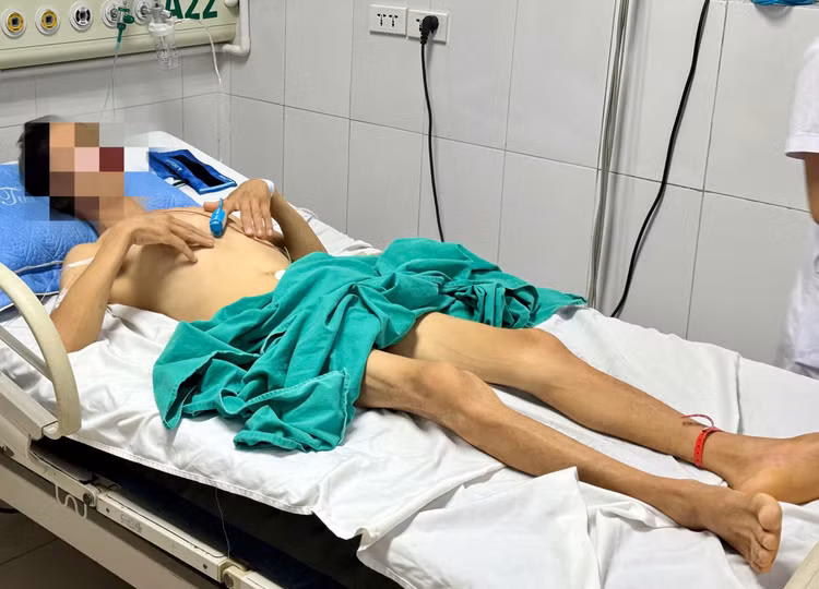 Bệnh nhân hiện đối mặt với nhiều nguy cơ nghiêm trọng, trong đó có khả năng mắc hội chứng nuôi ăn lại - Ảnh BVCC