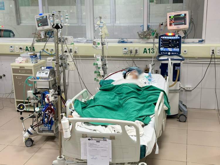 Bệnh nhân mắc cúm B được chỉ định can thiệp ECMO - Ảnh BVCC Bệnh nhân mắc cúm B được chỉ định can thiệp ECMO - Ảnh BVCC