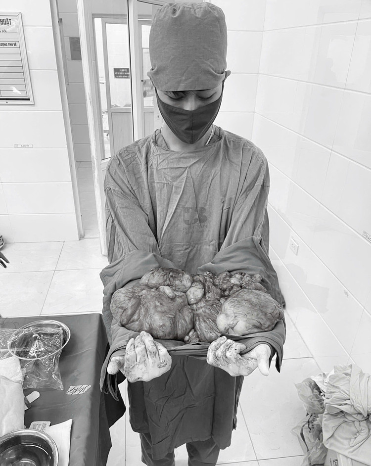 Toàn bộ khối u nặng hơn 8 kg đã được loại bỏ thành công. Ảnh: BVCC