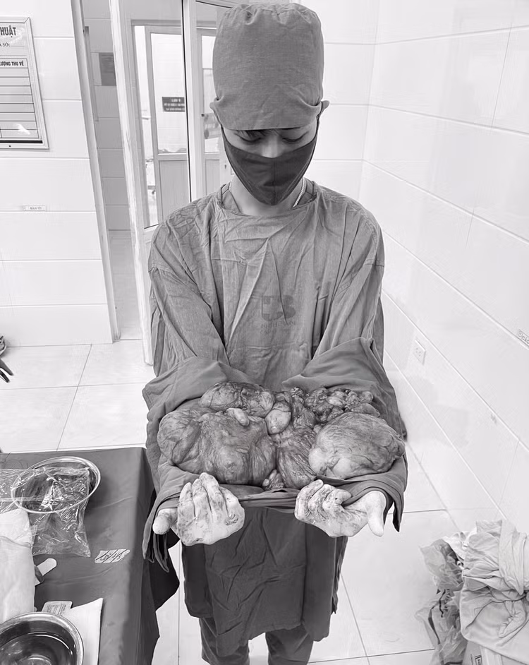 Toàn bộ khối u nặng hơn 8 kg đã được loại bỏ thành công. Ảnh: BVCC