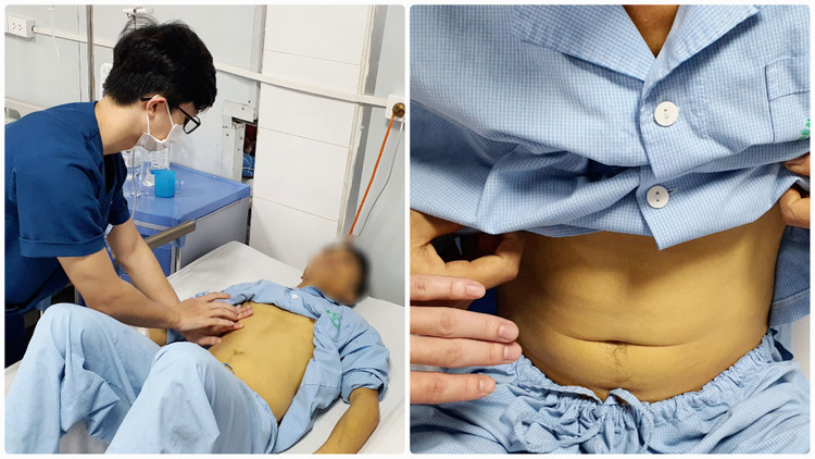 Bệnh nhân bị vàng da sau khi ăn loại nấm tự hái trên rừng - Ảnh BVCC