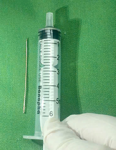 Chiếc kim khâu dài 5 cm được lấy ra - Ảnh BVCC