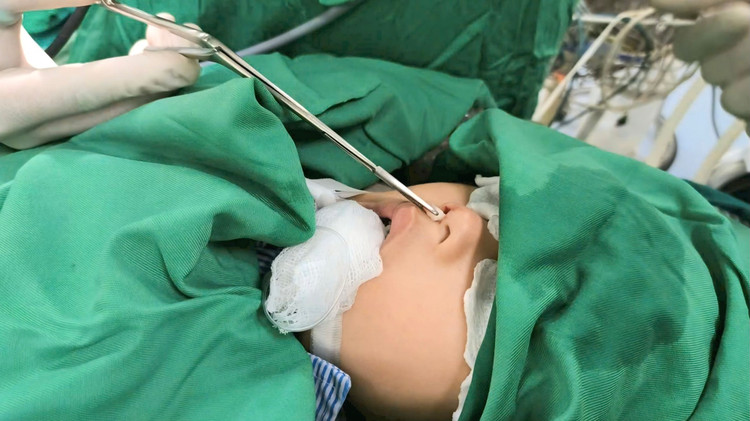 Ca phẫu thuật cho bệnh nhân - Ảnh BVCC