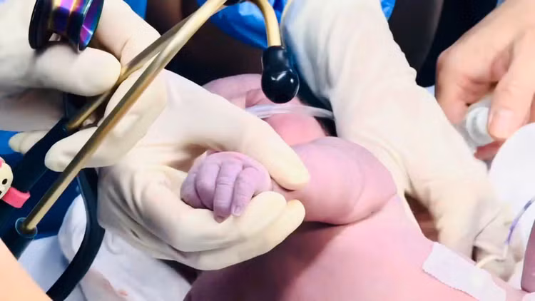 Cứu sống thai nhi bị suy tim bào thai nặng ảnh 3