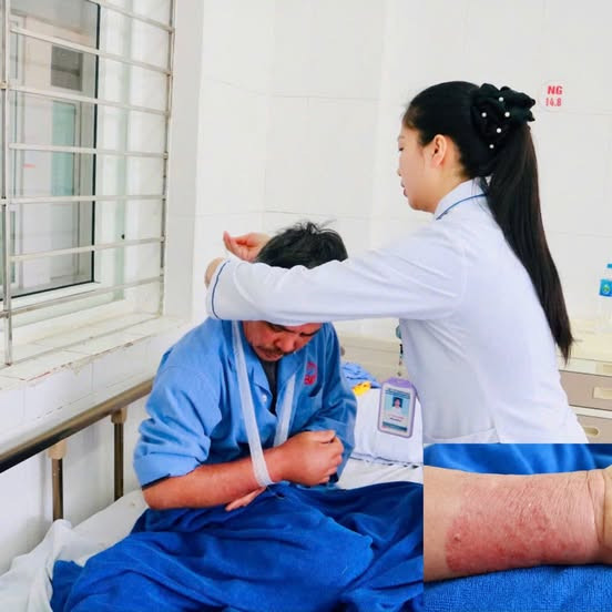 Đắp lá thuốc để giảm đau người đàn ông 51 tuổi bị sưng nề cánh tay.