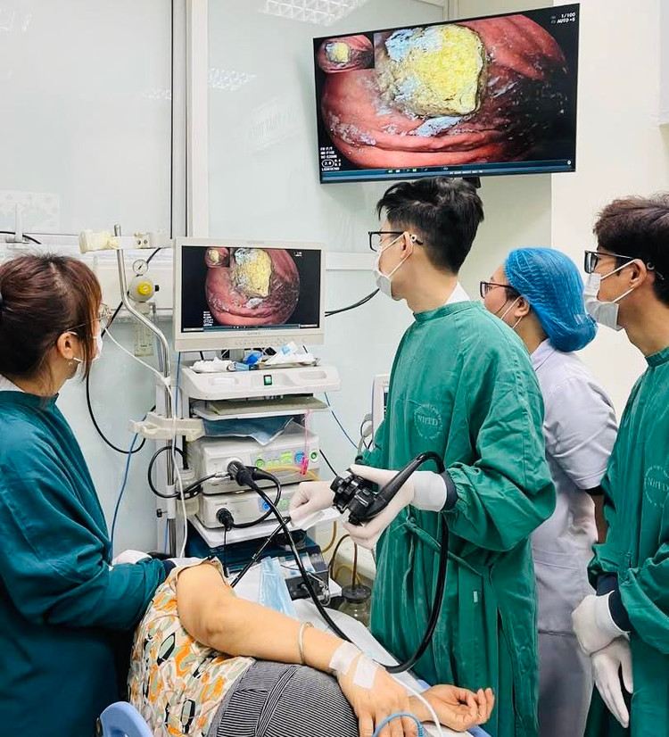 Nội soi phát hiện khối bã thức ăn trong dạ dày bệnh nhân - Ảnh BVCC