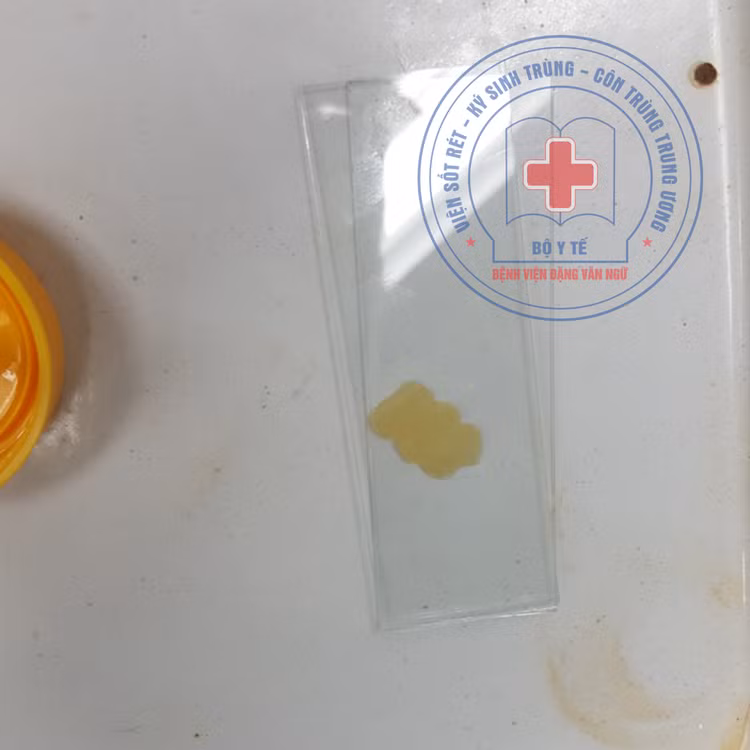 Đốt sán tự chui ra ngoài