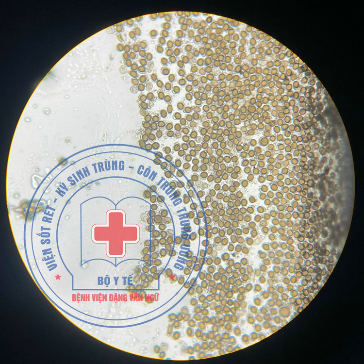 Nguồn nhiễm bệnh sán dây