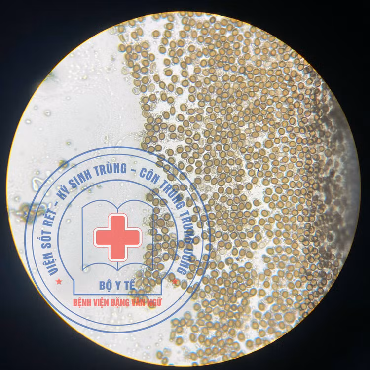 Nguồn nhiễm bệnh sán dây