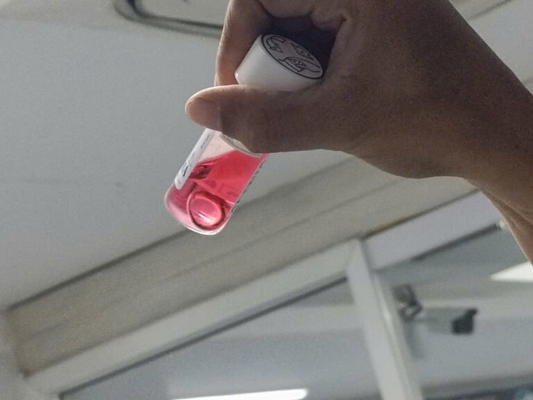 Hình ảnh giác mạc của một người bệnh chết não - Ảnh BVCC