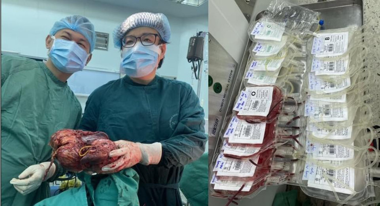 Khối u gan nặng hơn 3kg đã được cắt bỏ