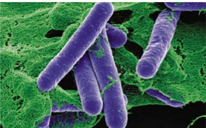 Vi khuẩn Clostridium botulinum - ảnh minh họa