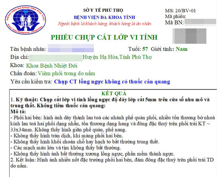 Kết quả chụp cắt lớp vi tính của người bệnh - Ảnh BVCC