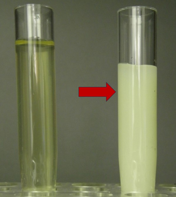 Dấu hiệu lạ ở nước tiểu cảnh báo bệnh không nên chủ quan ảnh 1