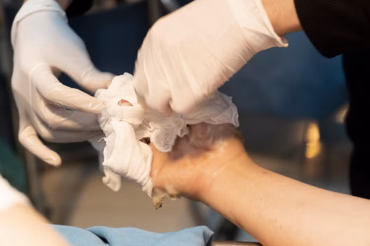 Xử lý cấp cứu cho bệnh nhân bỏng - Ảnh BVCC