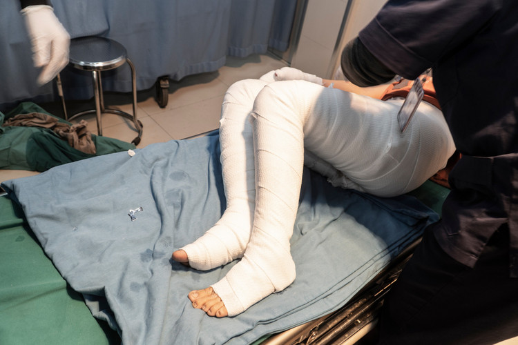 Bệnh nhân bị bỏng gas nghiêm trọng được cấp cứu tại Trung tâm cấp cứu 115 bệnh viện đa khoa Hùng Vương - Ảnh BVCC