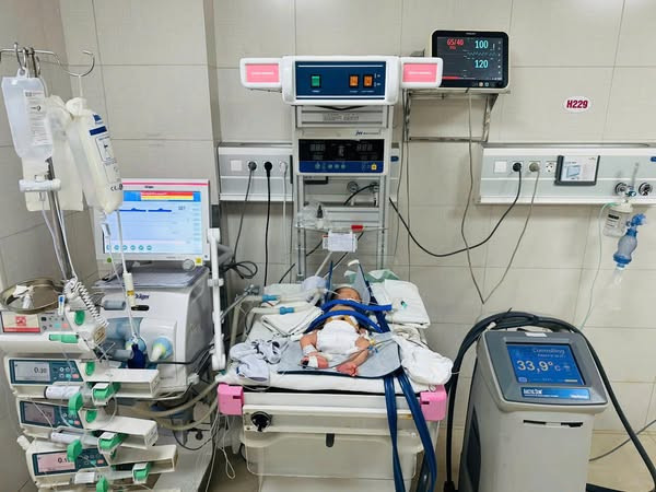 Hình ảnh bệnh nhi được điều trị bằng phương pháp hạ thân nhiệt chỉ huy - Ảnh BVCC