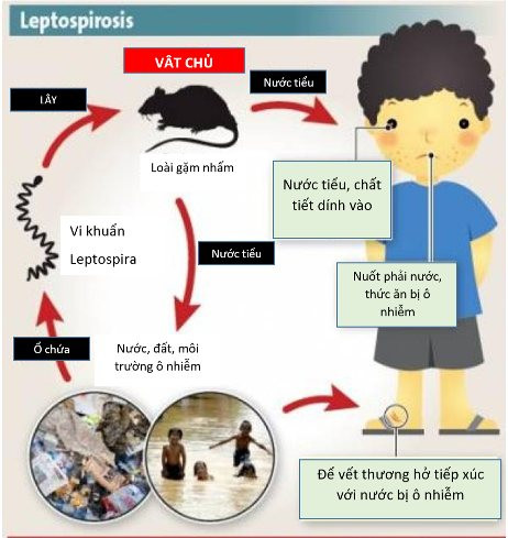 Nhiều trẻ nhiễm xoắn khuẩn Leptospira