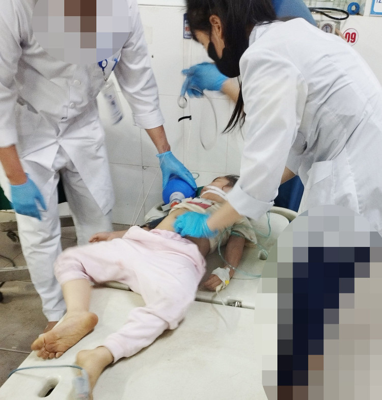 Bé 5 tuổi suy hô hấp vì bị hóc quả nhãn - Ảnh: BVCC