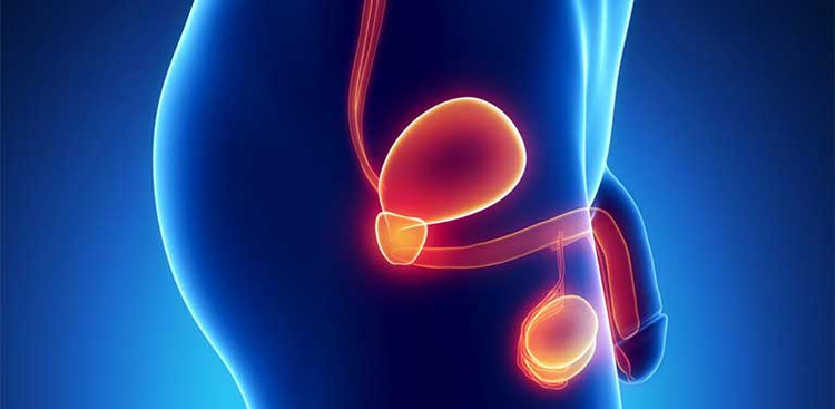 Tinh hoàn to ra là một trong những dấu hiệu của ung thư tinh hoàn - Ảnh minh họa