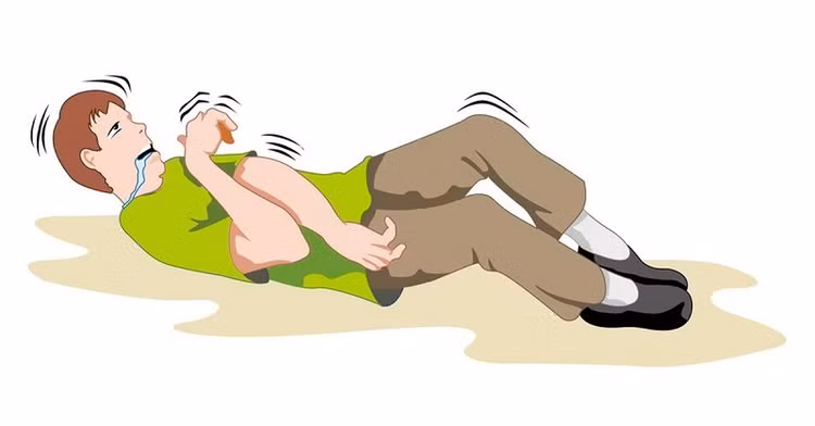 Cơn động kinh - Ảnh BSCC