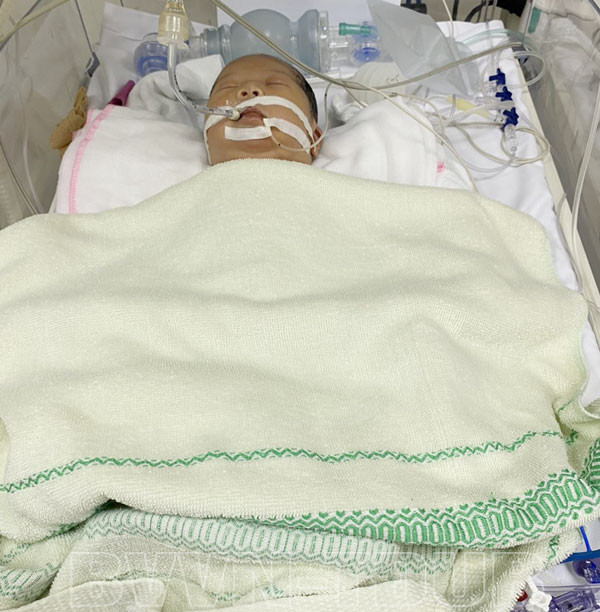 Trẻ phải tách mẹ và điều trị hồi sức tích cực tại khoa Sơ sinh