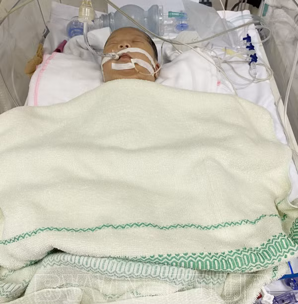 Trẻ phải tách mẹ và điều trị hồi sức tích cực tại khoa Sơ sinh