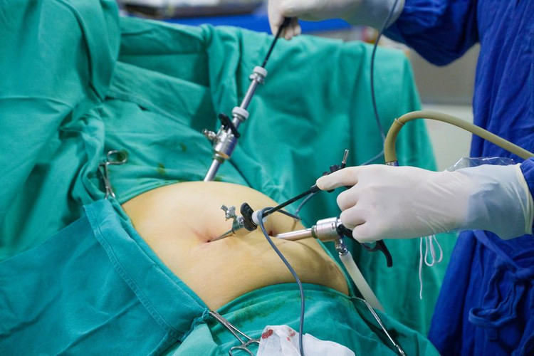 Đau bụng, rối loạn tiêu hóa không ngờ phải cắt túi mật vì u cơ