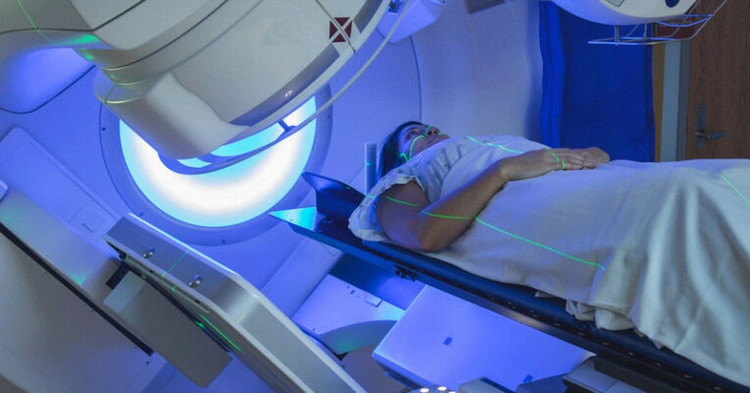 Chấn đoán phát hiện sớm ung thư phổi - Ảnh minh họa