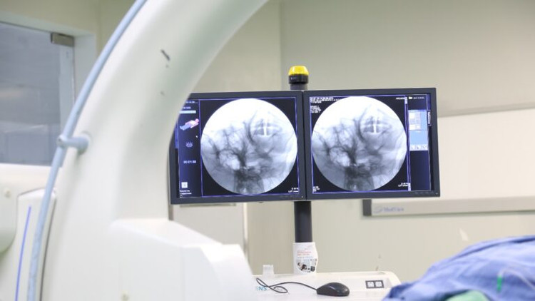 Bác sĩ đang trực tiếp đốt sóng cao tần xung cho người bệnh