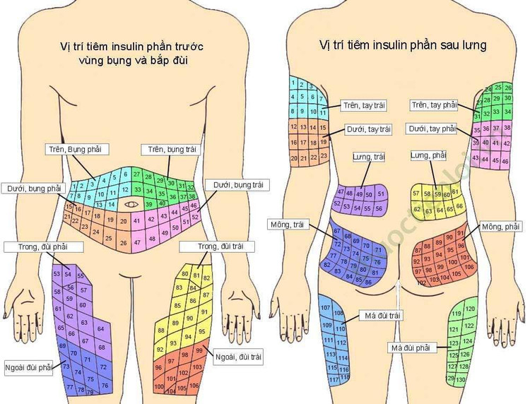 Vị trí tiêm insulin