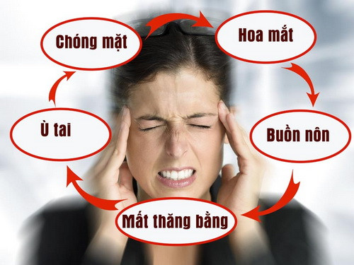 Biểu hiện của rối loạn tiền đình - Ảnh minh họa