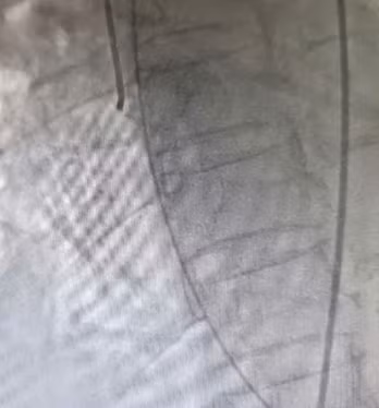 Đang hồi sức tích cực do chấn thương sọ não thì “vỡ tim” do căng thẳng ảnh 5