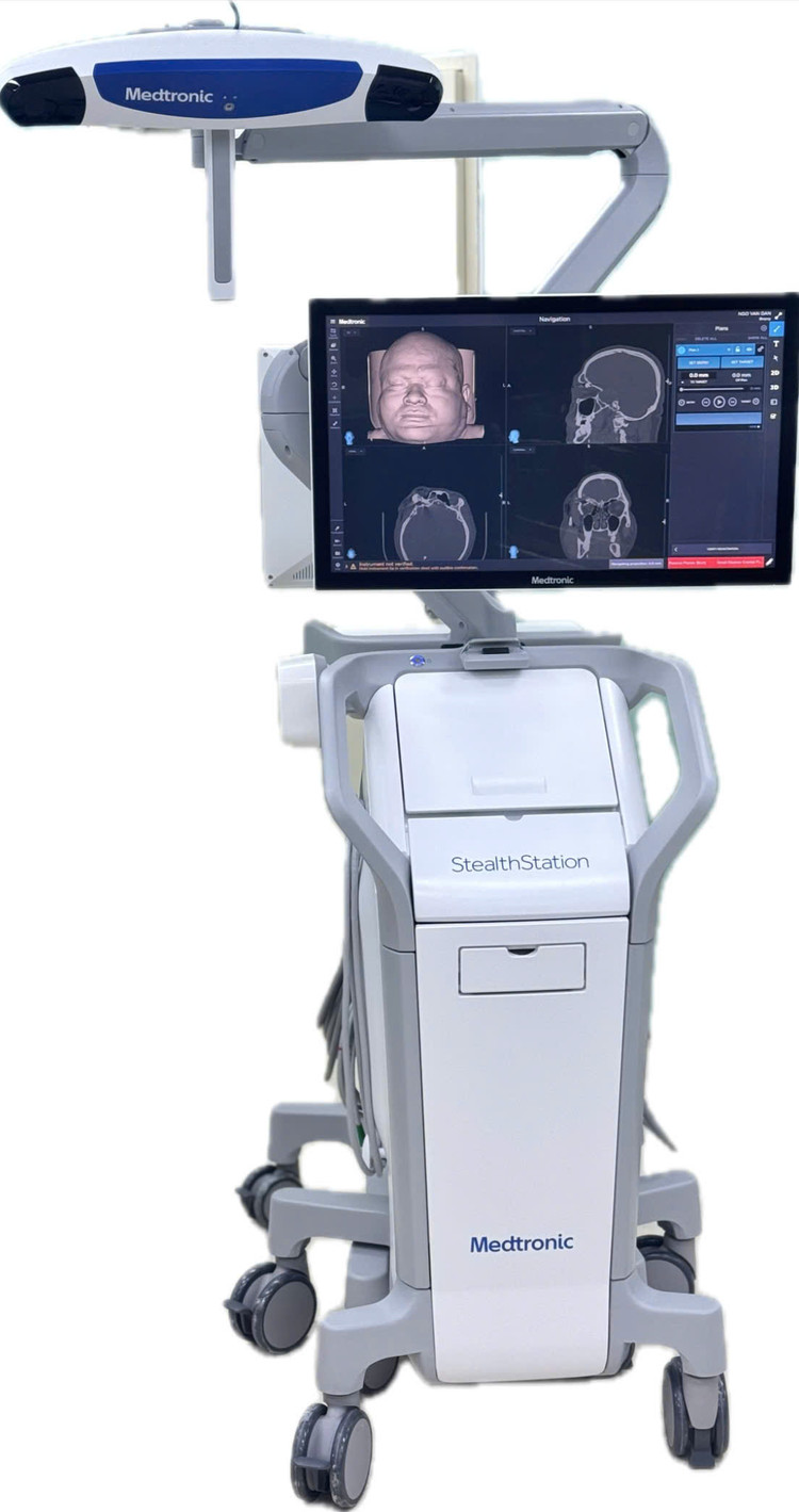 Các bác sĩ sử dụng hệ thống Navigation S8 để lấy dị vật cho nam bệnh nhân - Ảnh BVCC