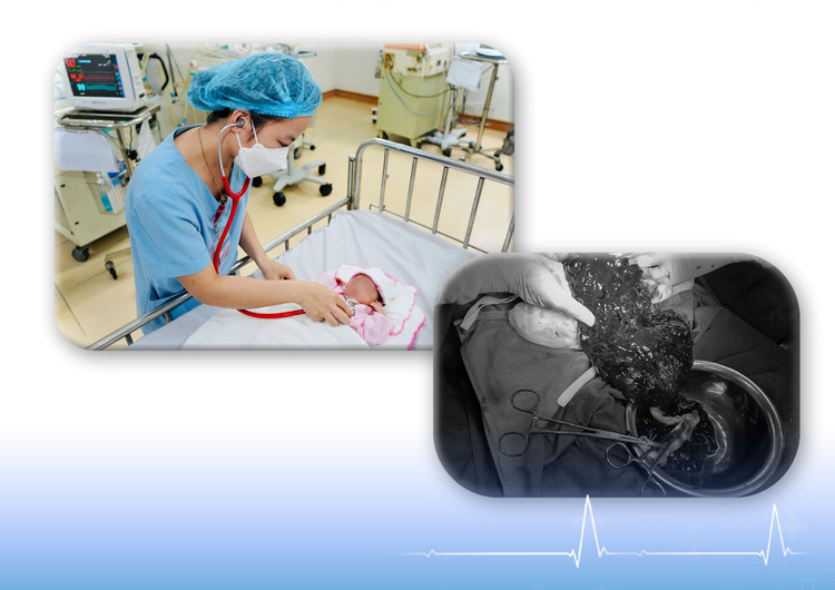 Cứu sống mẹ con sản phụ bị rau bong non thể nặng ảnh 1