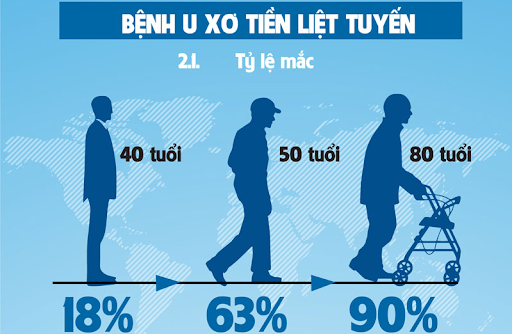 Bệnh tuyến tiền liệt tăng theo tuổi - Ảnh BVCC