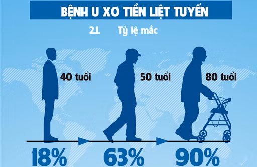 Bệnh tuyến tiền liệt tăng theo tuổi - Ảnh BVCC