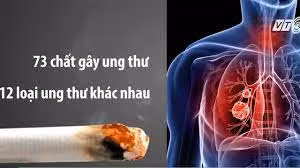 Chuyên gia chỉ rõ các loại ung thư do thuốc lá gây ra ảnh 1
