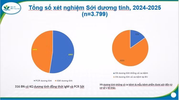 Biểu đồ thống kê xét nghiệm sởi dương tính trong thời gian 2024-2025 tại Bệnh viện Nhi Trung ương - Ảnh BVCC
