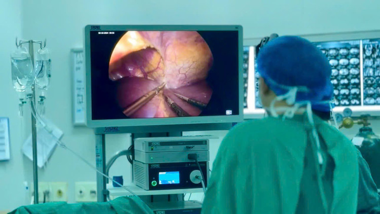 Nội soi nhìn rõ khối u - Ảnh BVCC