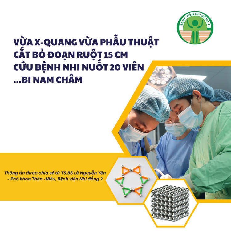 Bệnh viện nhi đồng 2 thực hiện ca phẫu thuật lấy nam châm cho bệnh nhi - Ảnh BVCC