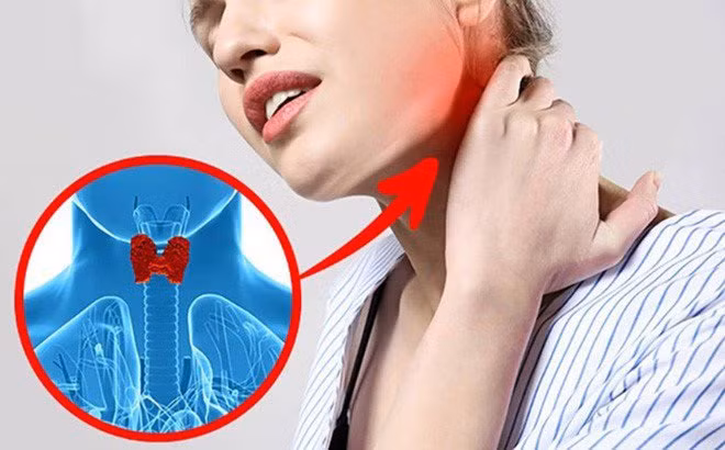 Vì sao suy giáp gây tăng cân mất kiểm soát? - Ảnh minh họa