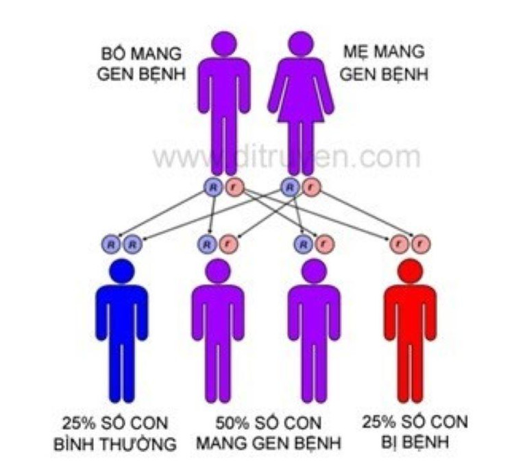 Ảnh hưởng của gen di truyền tới sinh con bị bệnh