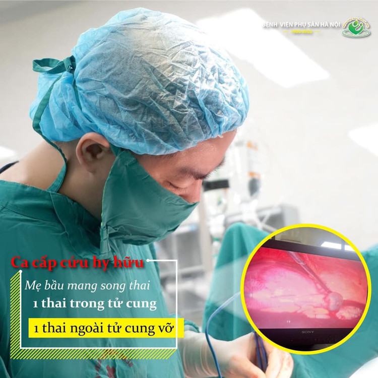 Ca phẫu thuật cho bà mẹ mang song thai - Ảnh BVCC