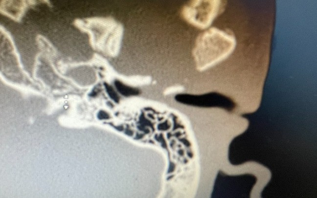 Hình ảnh trước phẫu thuật Hình ảnh trước phẫu thuật