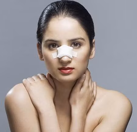 Bác sĩ chỉ cách chăm sóc sau nâng mũi ảnh 1