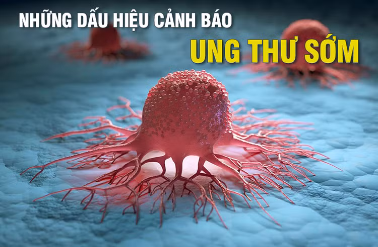 Những dấu hiệu cảnh báo ung thư sớm ảnh 1